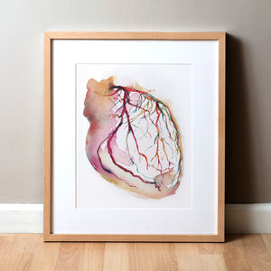Framed watercolor painting showing a coronary angiogram x-ray image in reds, purples, greens, oranges and yellows.