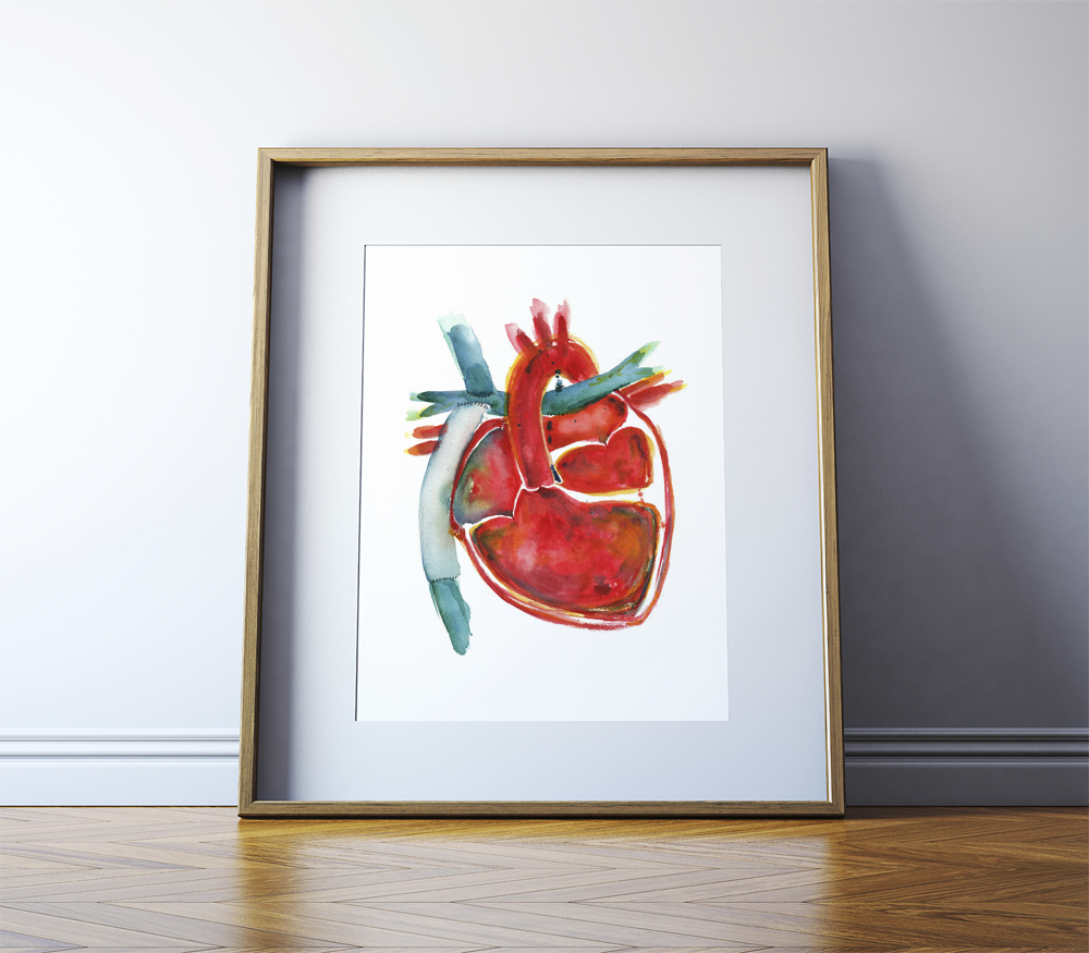 Hypoplastic Left Heart Syndrome (HLHS)