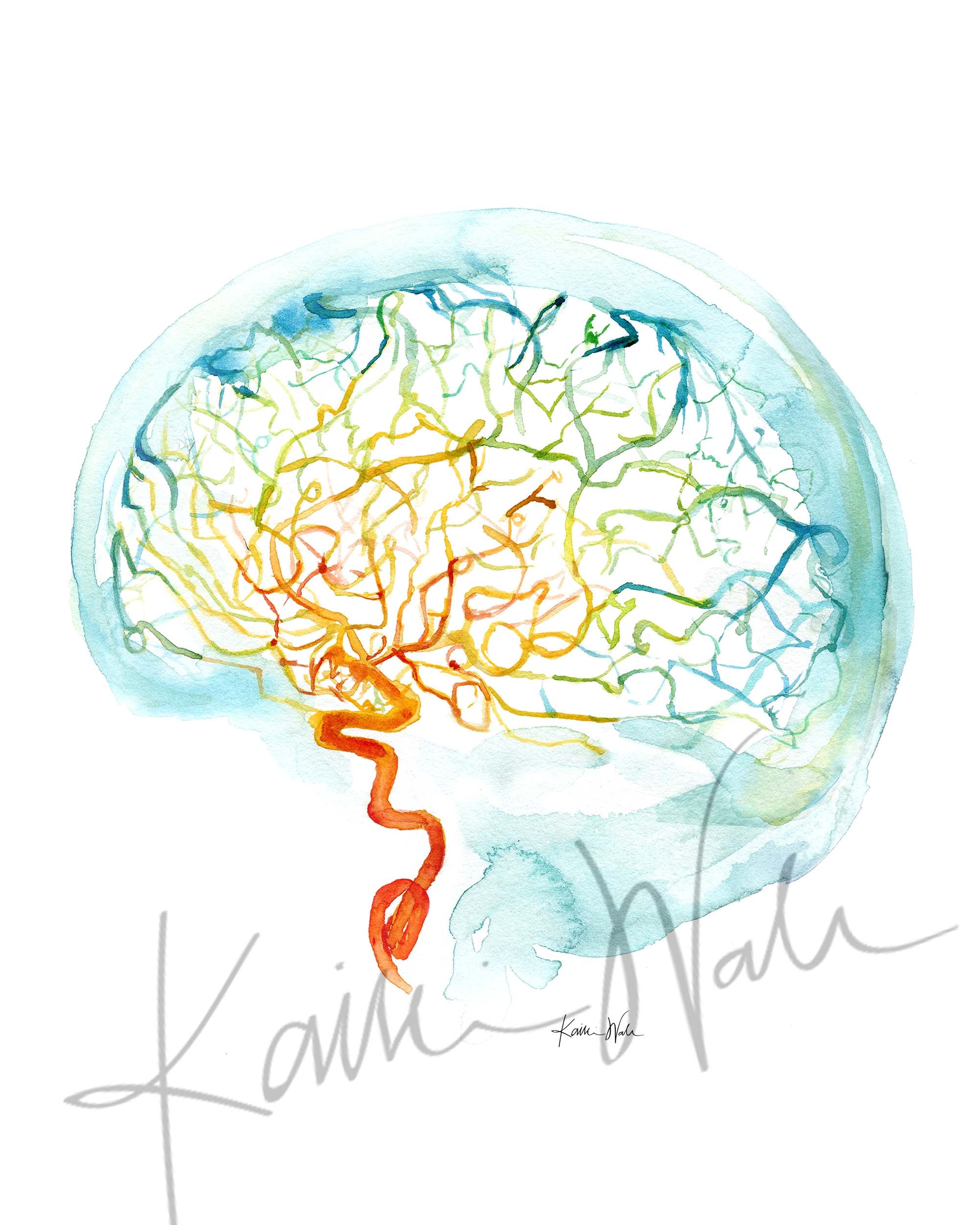Rainbow Cerebral Angiography Watercolor Print