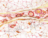 Gilded Hypodermis Watercolor Print