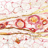 Gilded Hypodermis Watercolor Print