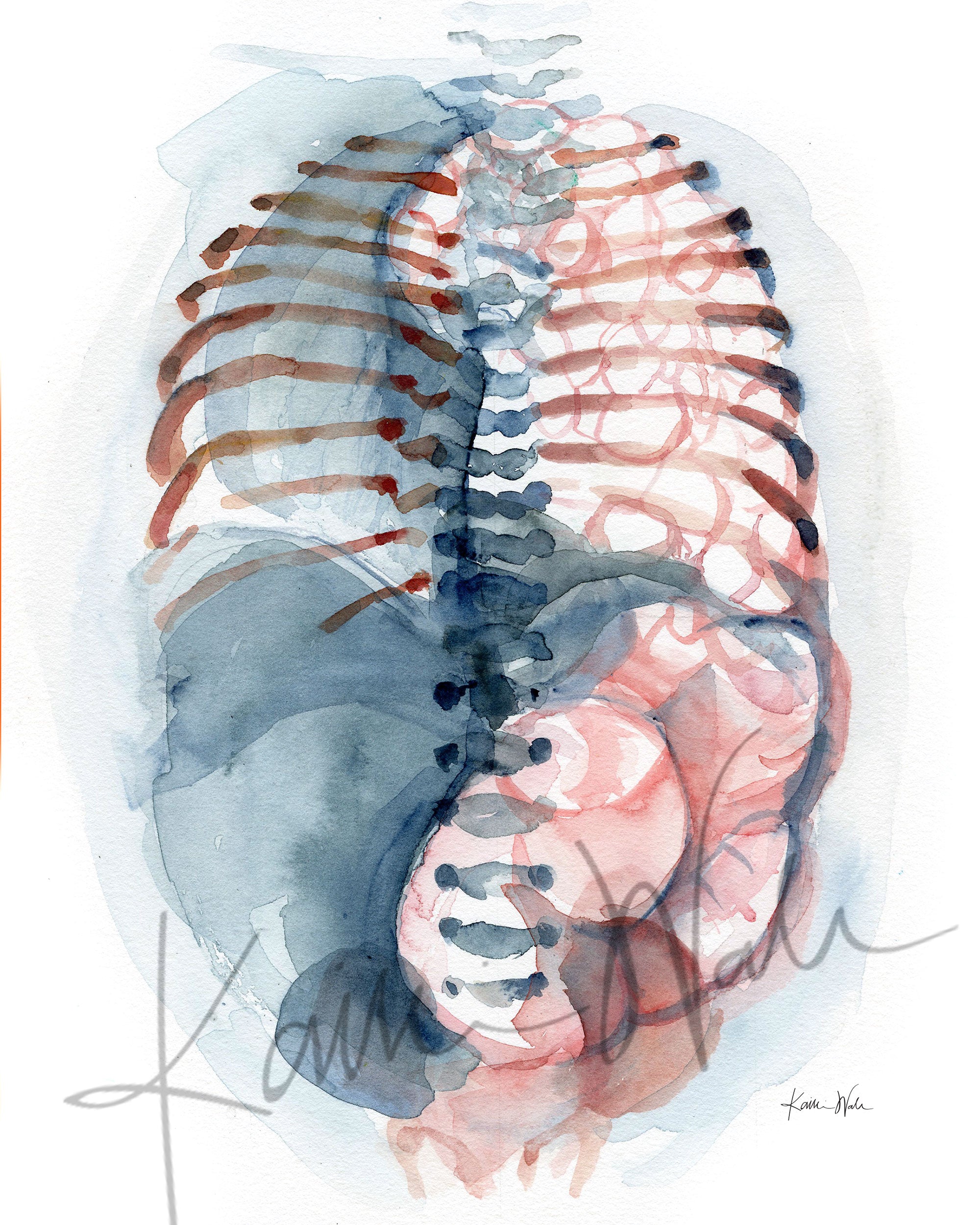 Unframed watercolor painting of a diaphragmatic hernia.