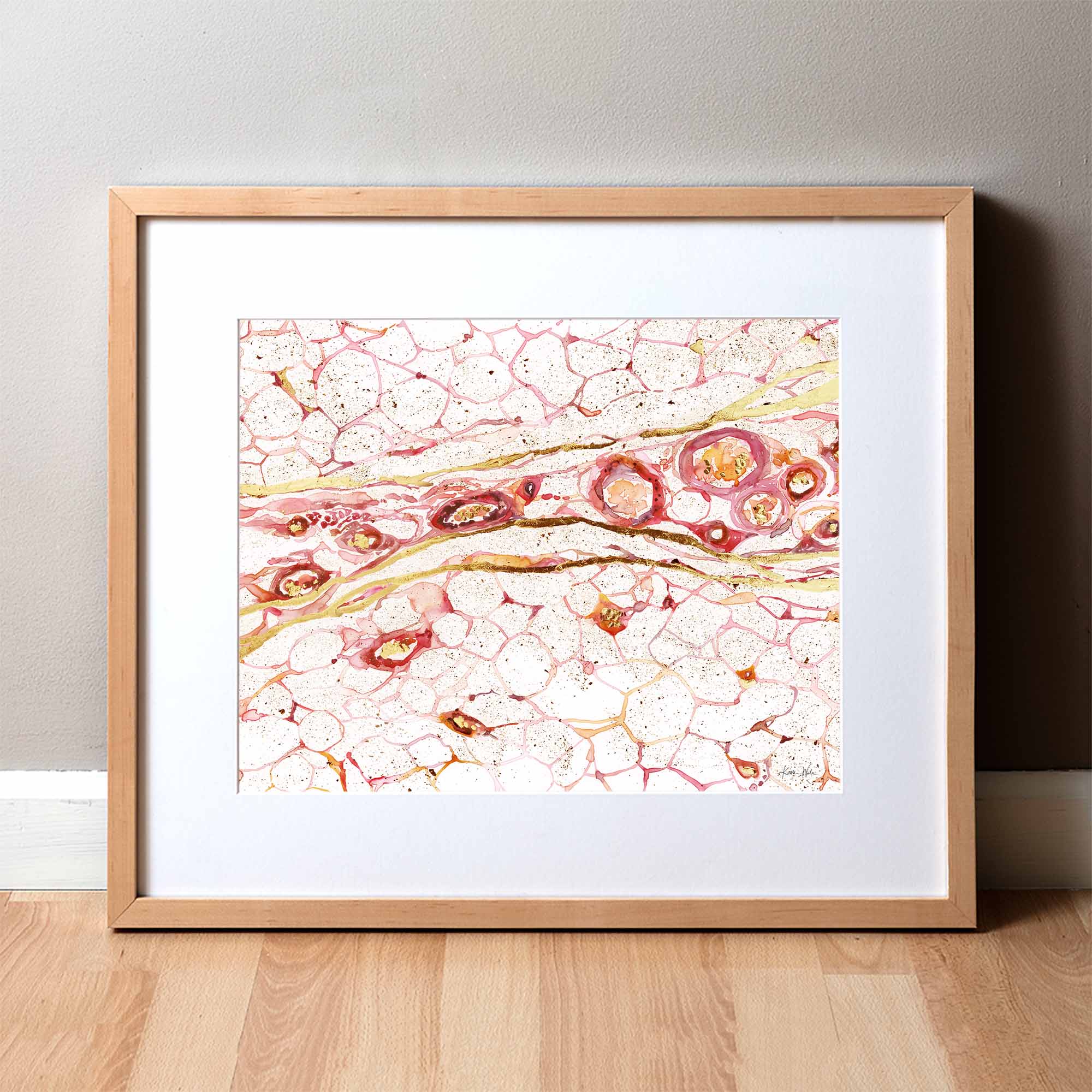 Gilded Hypodermis Watercolor Print
