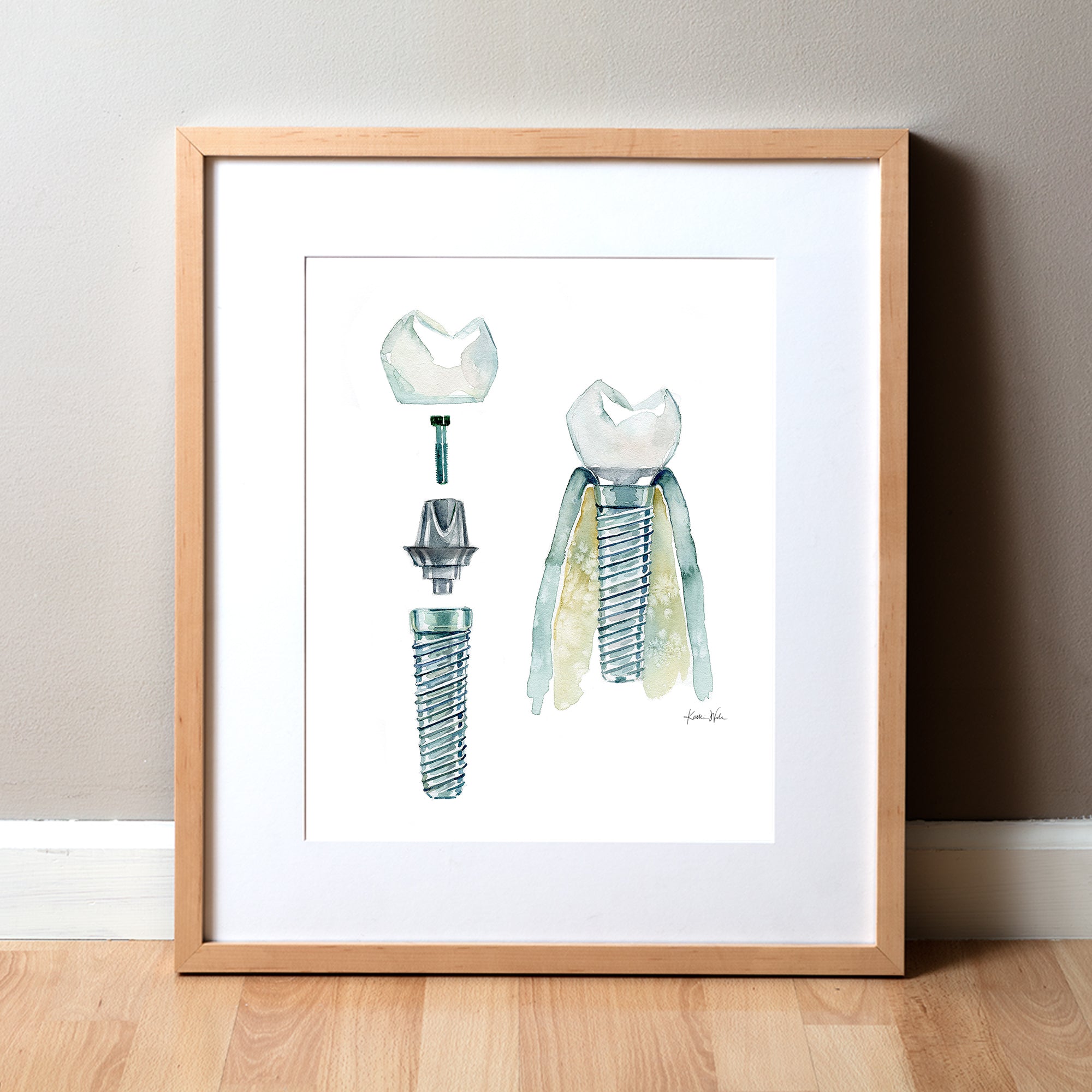 Dental Implant Watercolor Print