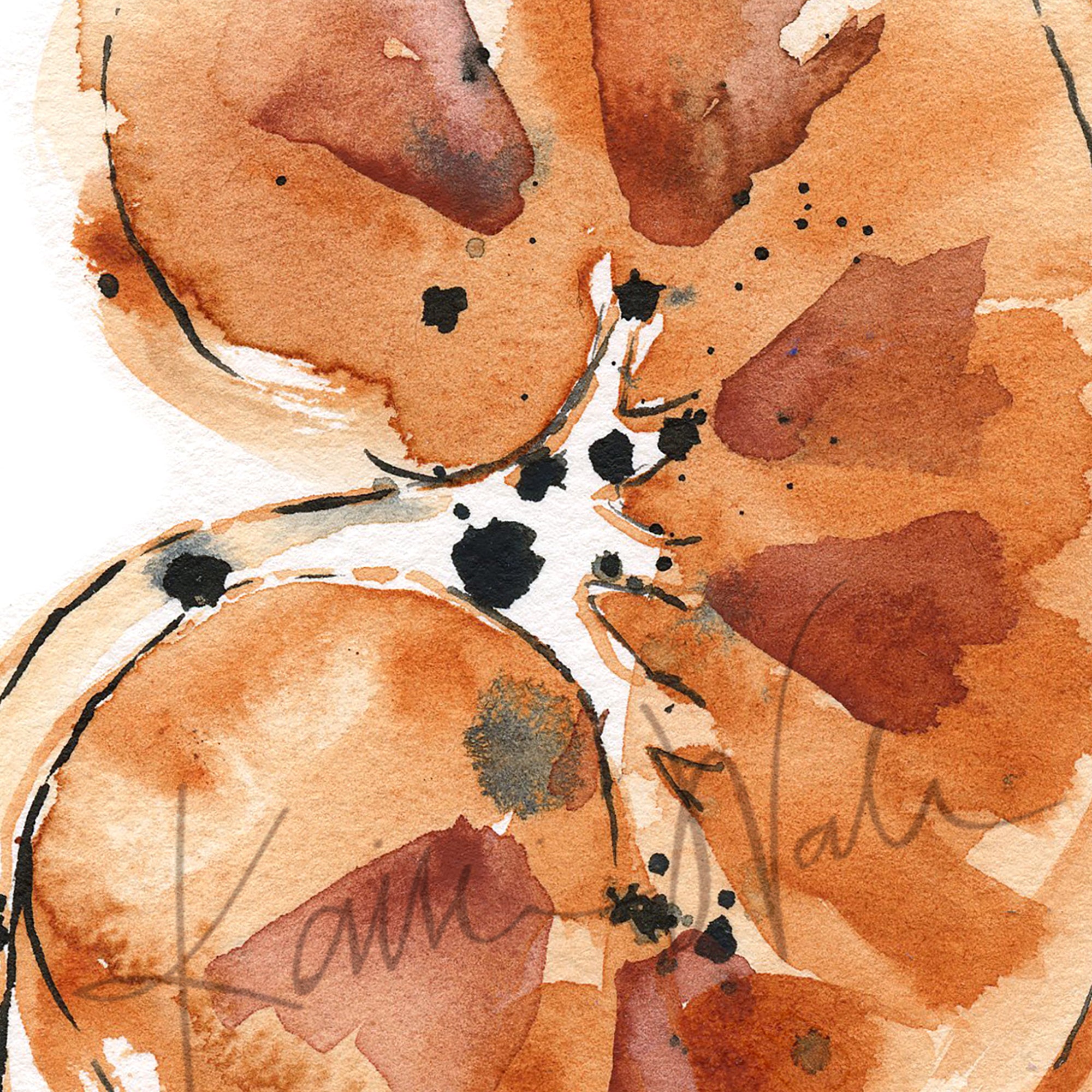 Kidney Stones Watercolor Print