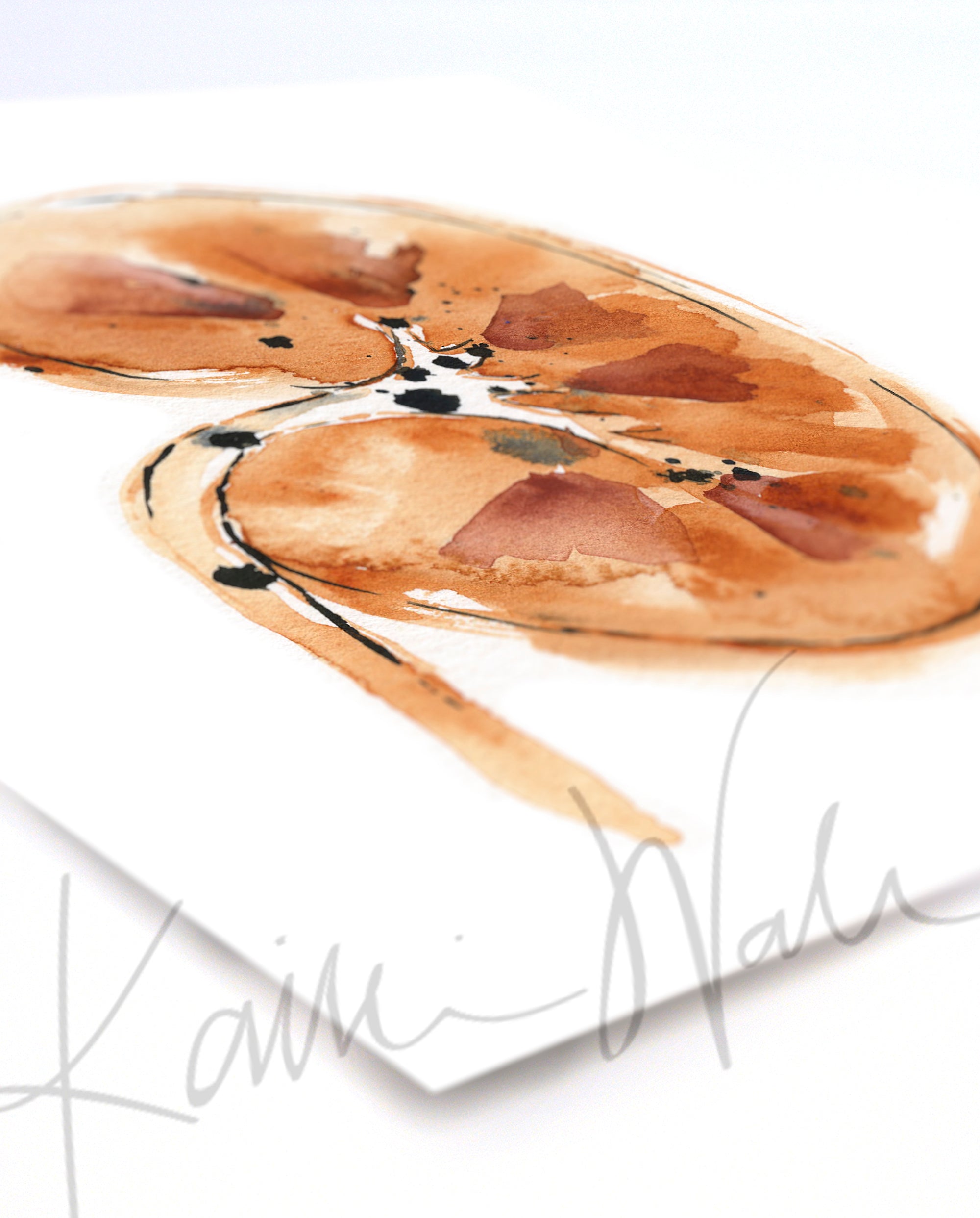 Kidney Stones Watercolor Print