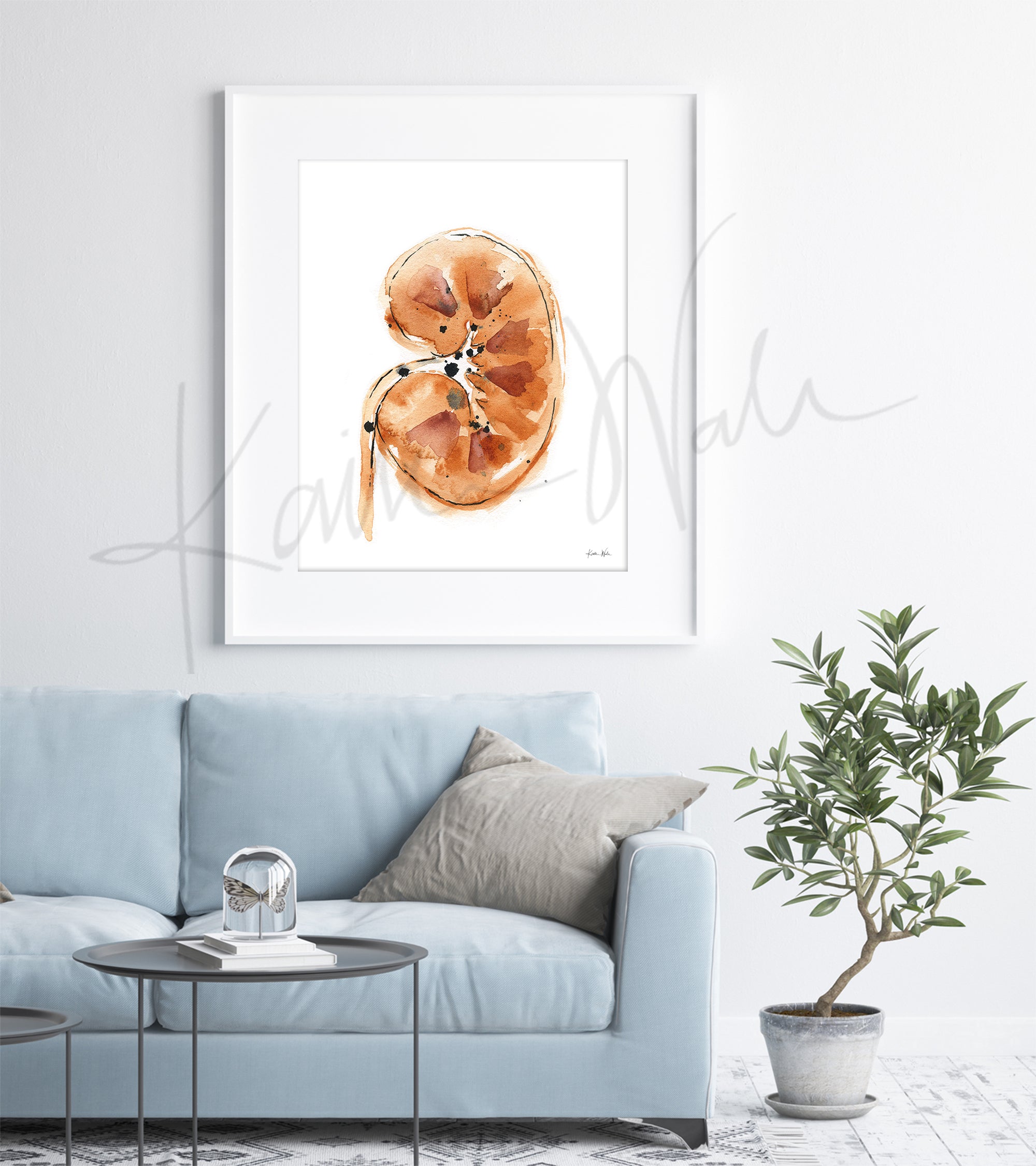 Kidney Stones Watercolor Print