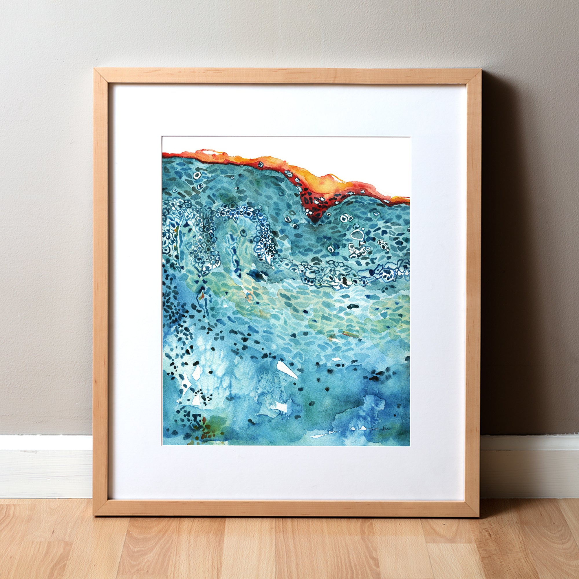 Melanoma in Blue Watercolor Print