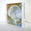 Urology Desktop Anatomy Art - Acrylic Framed Mini Print