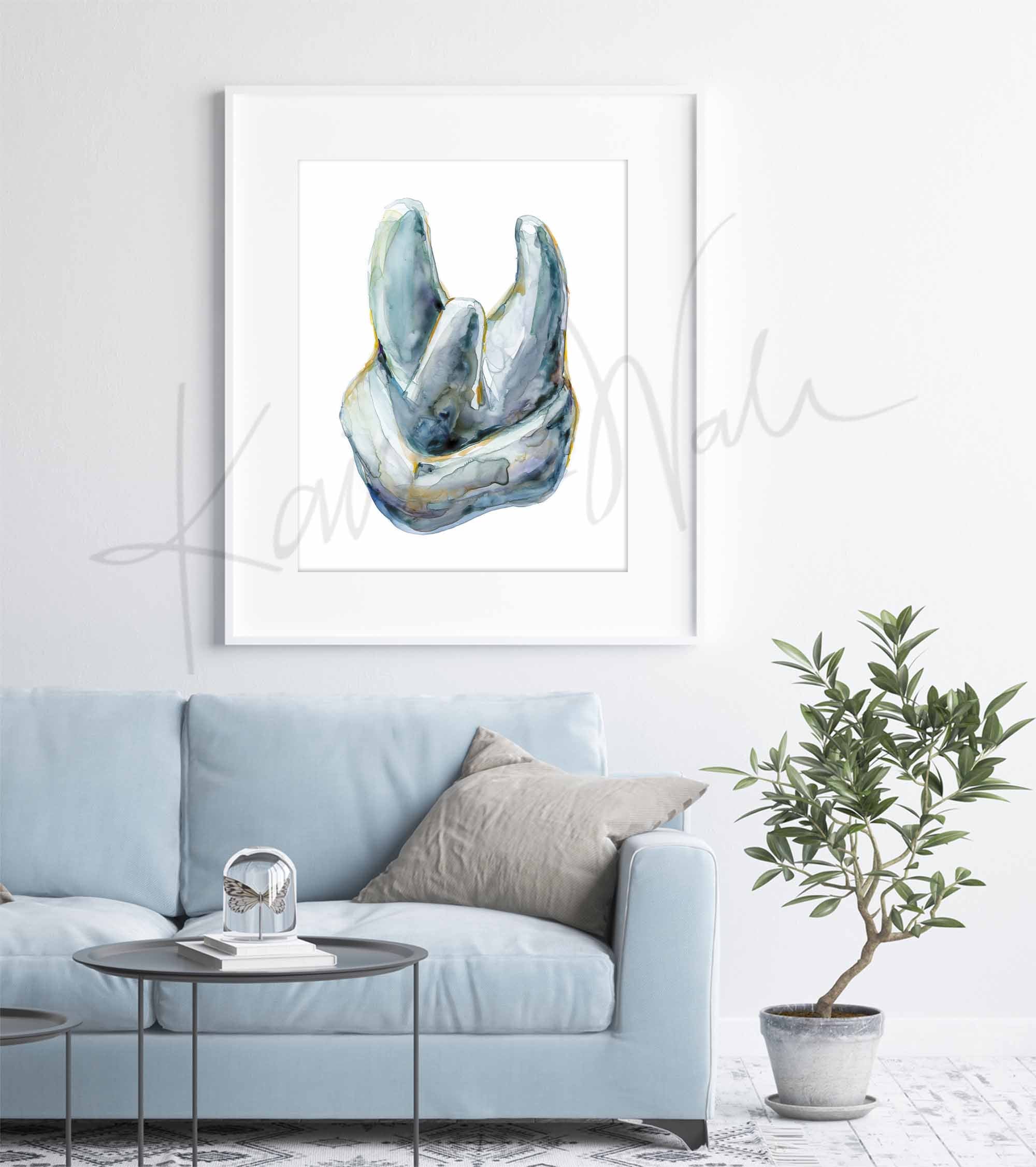 View of Roots Molar Watercolor Print