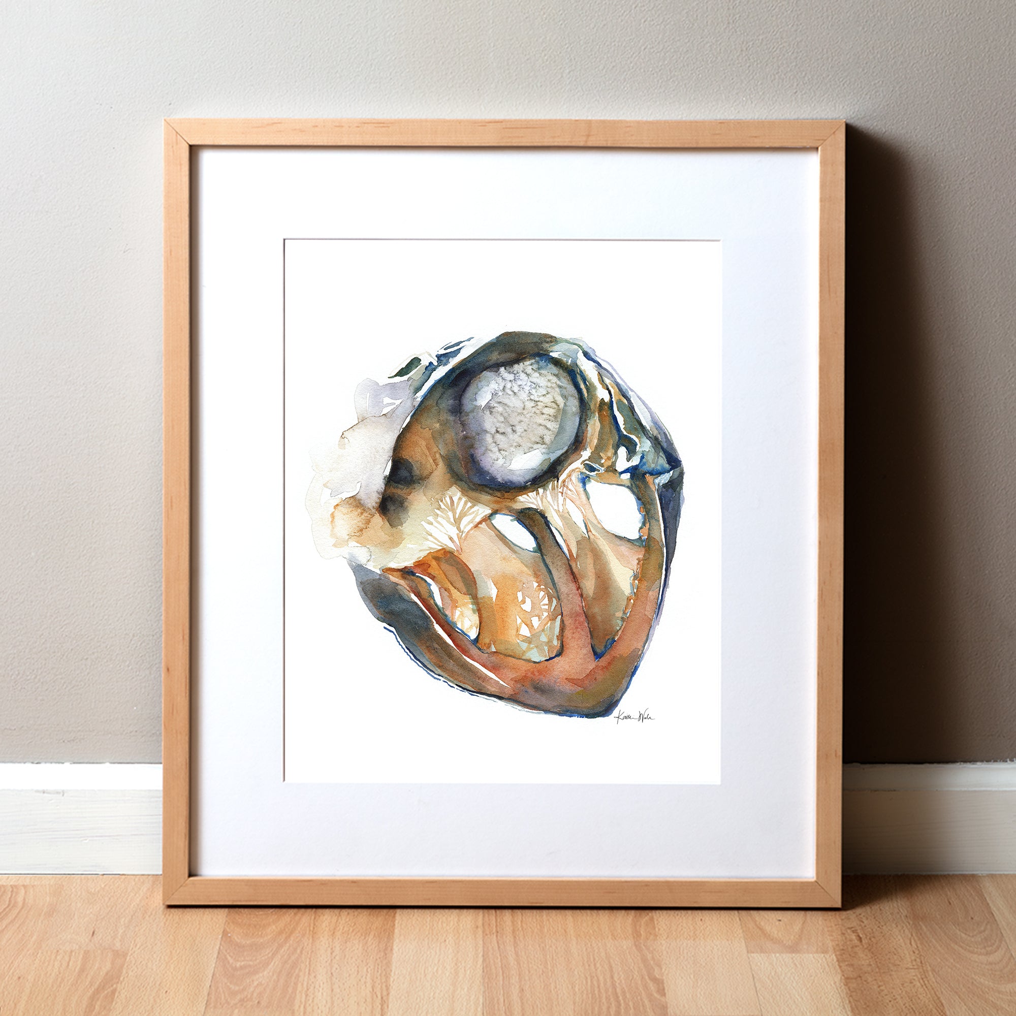 Myxoma Watercolor Print