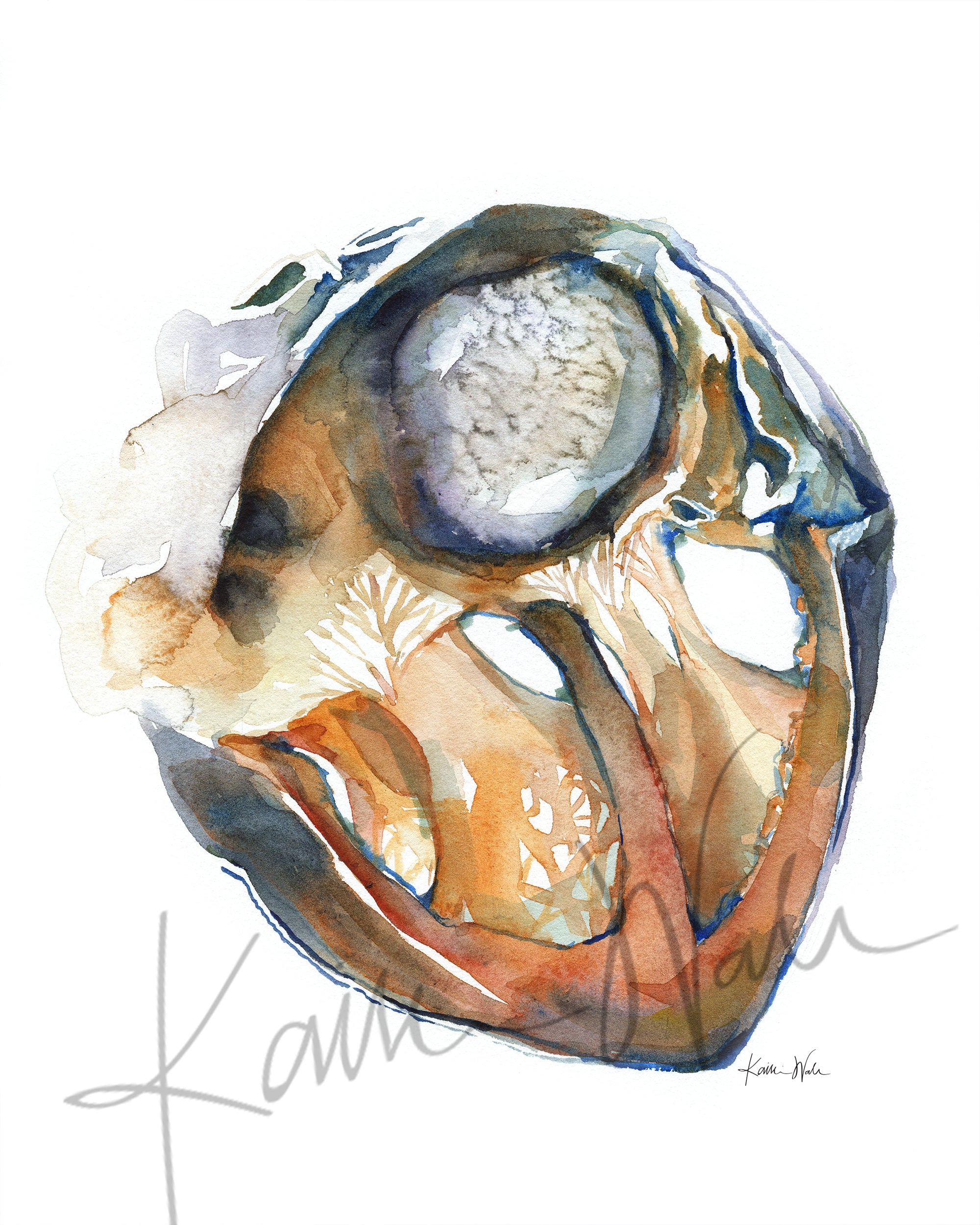 Myxoma Watercolor Print
