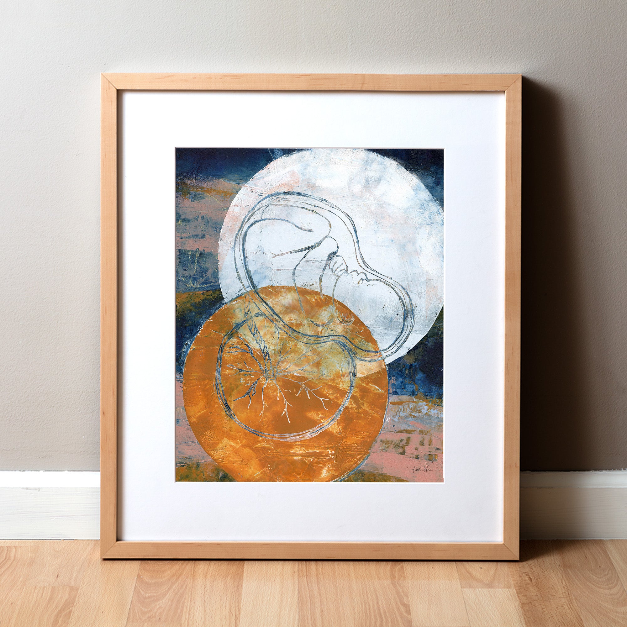 Oil and cold wax fine art print of a baby and placenta. Abstract anatomy art that is a great gift for new moms or OBGYN clinics.