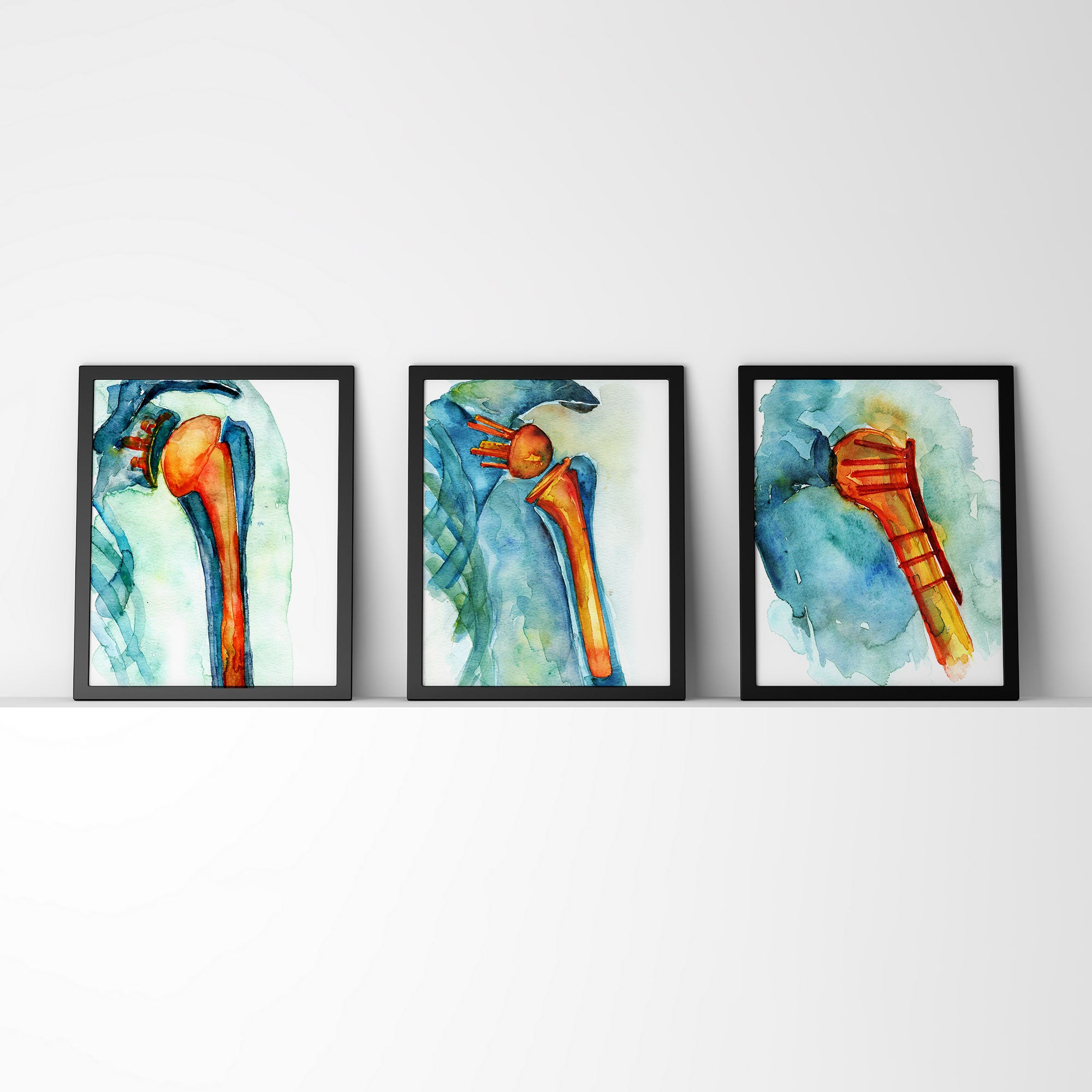 Orthopedic Hardware Watercolor Print Set