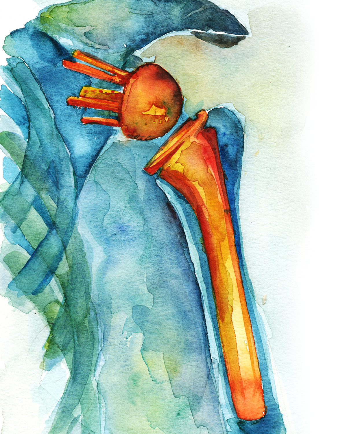 Orthopedic Hardware Watercolor Print Set