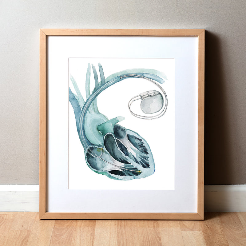 Framed watercolor artwork of an anatomical heart with a pacemaker and leads