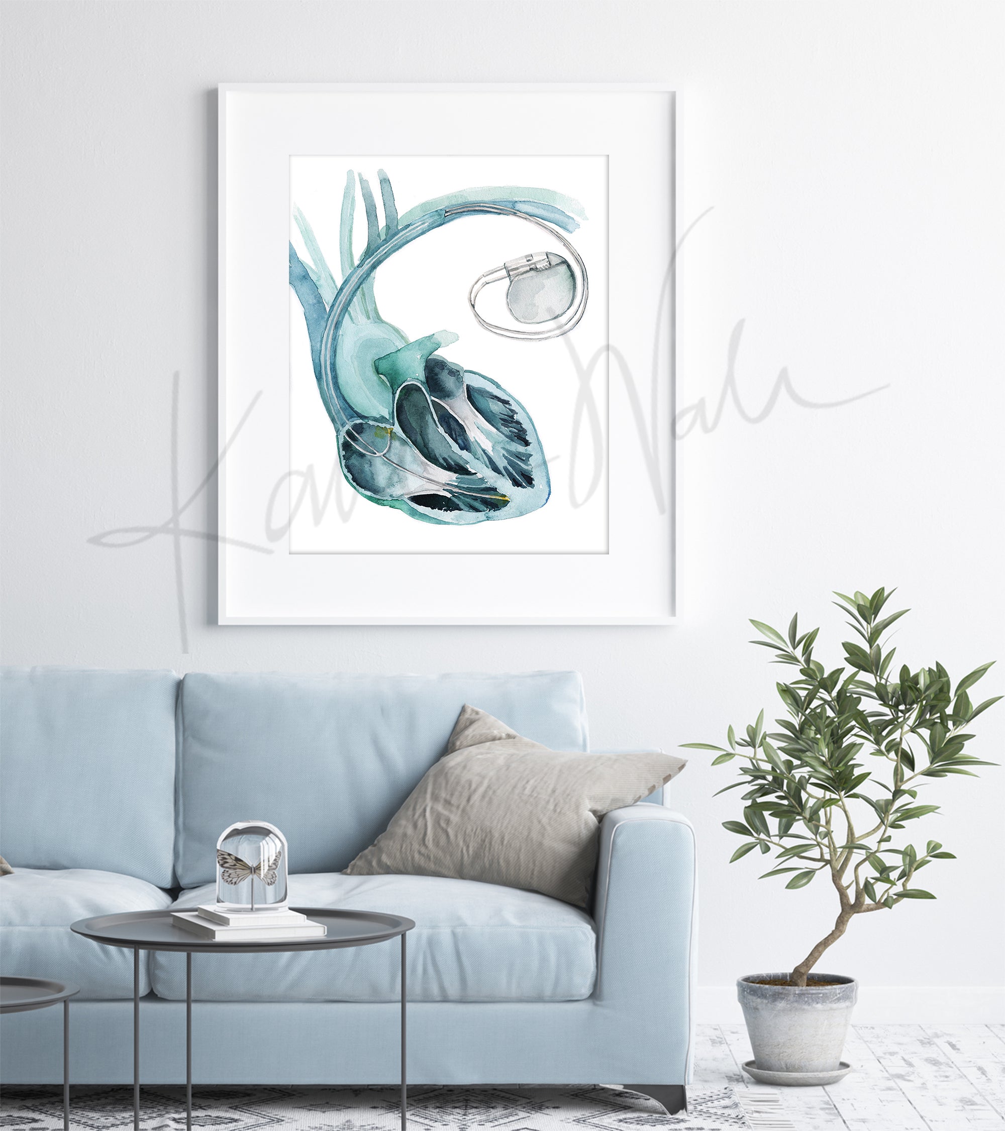 Anatomical Heart and Pacemaker Watercolor Art Print