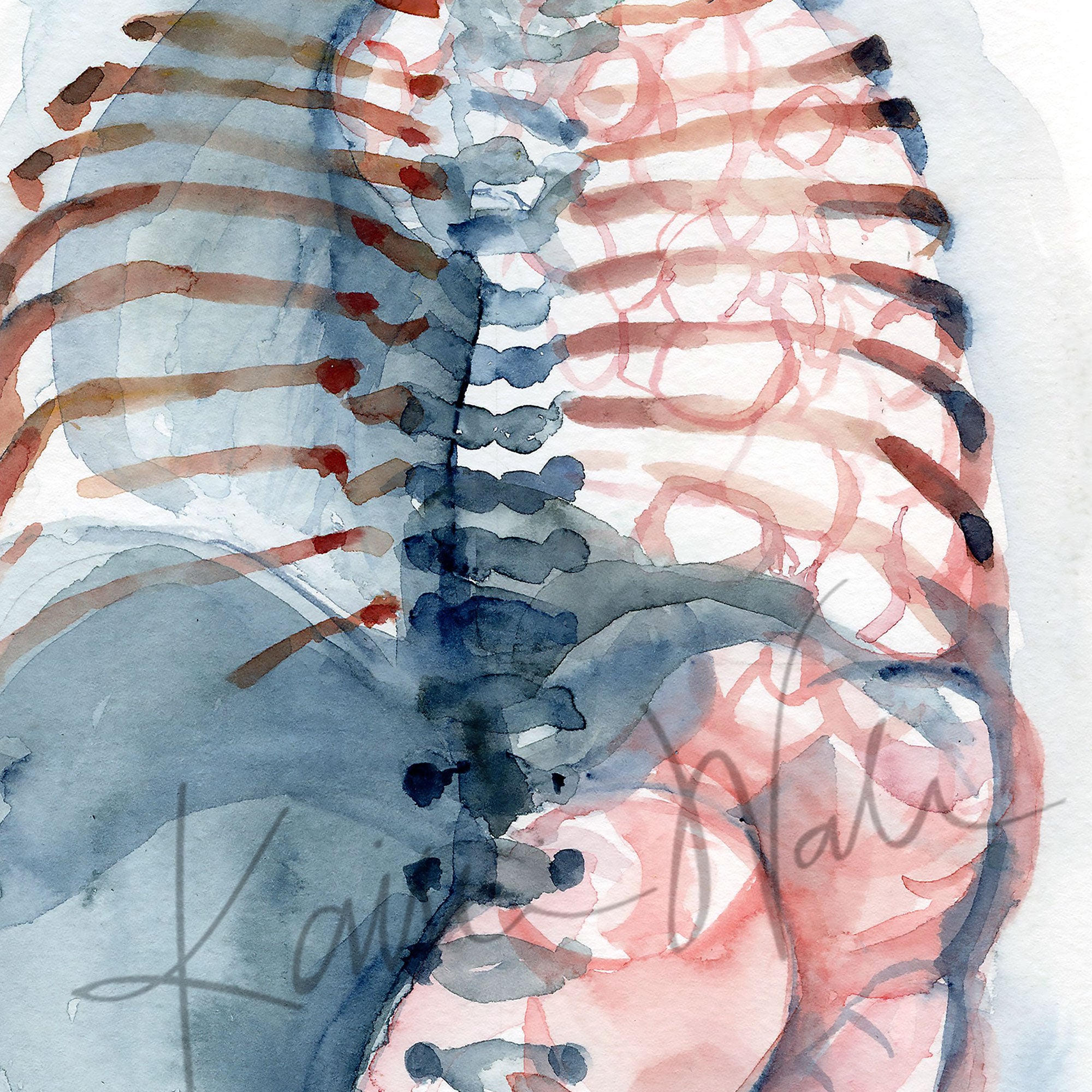 Zoomed in view of a watercolor painting of a diaphragmatic hernia.