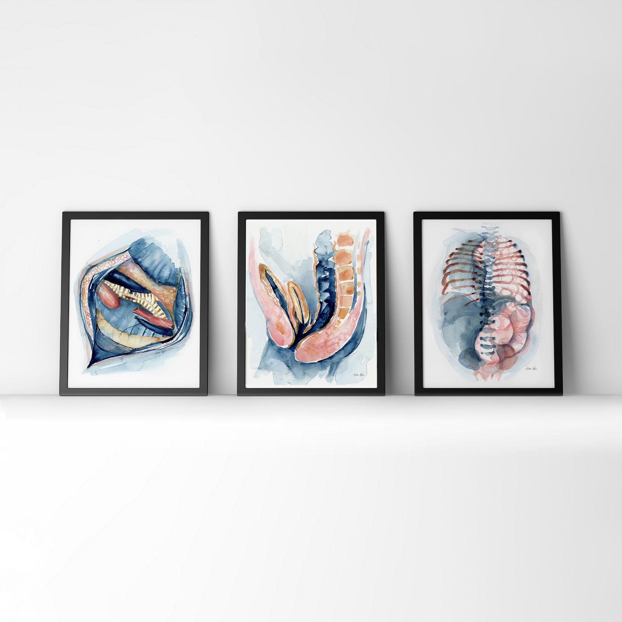 Framed watercolor painting set of three pediatric surgery paintings.