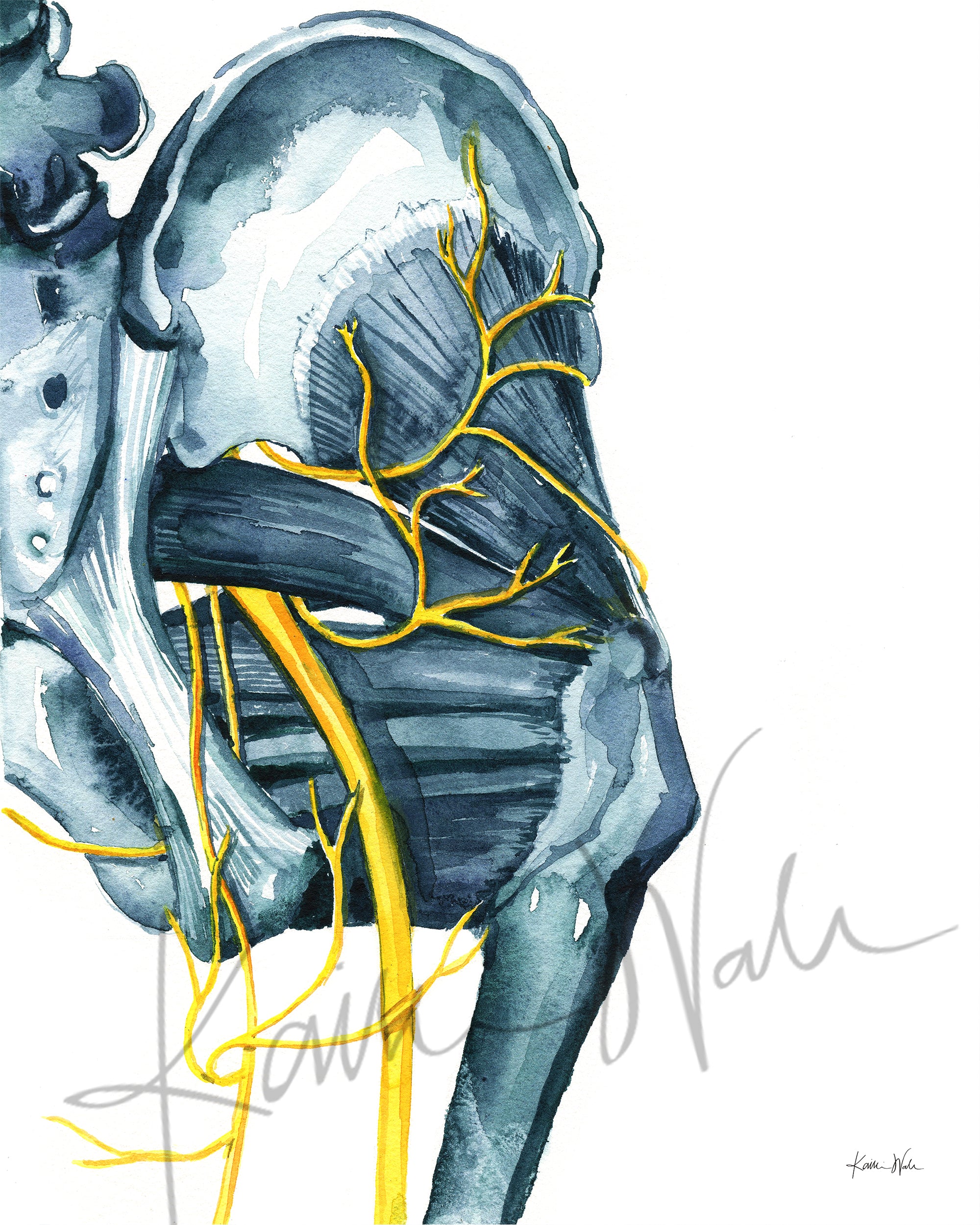 Sciatica Watercolor Print