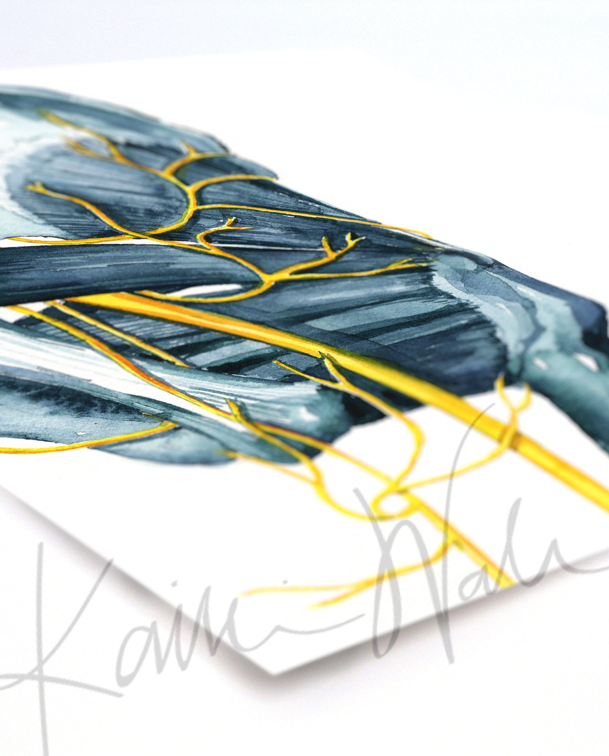 Sciatica Watercolor Print