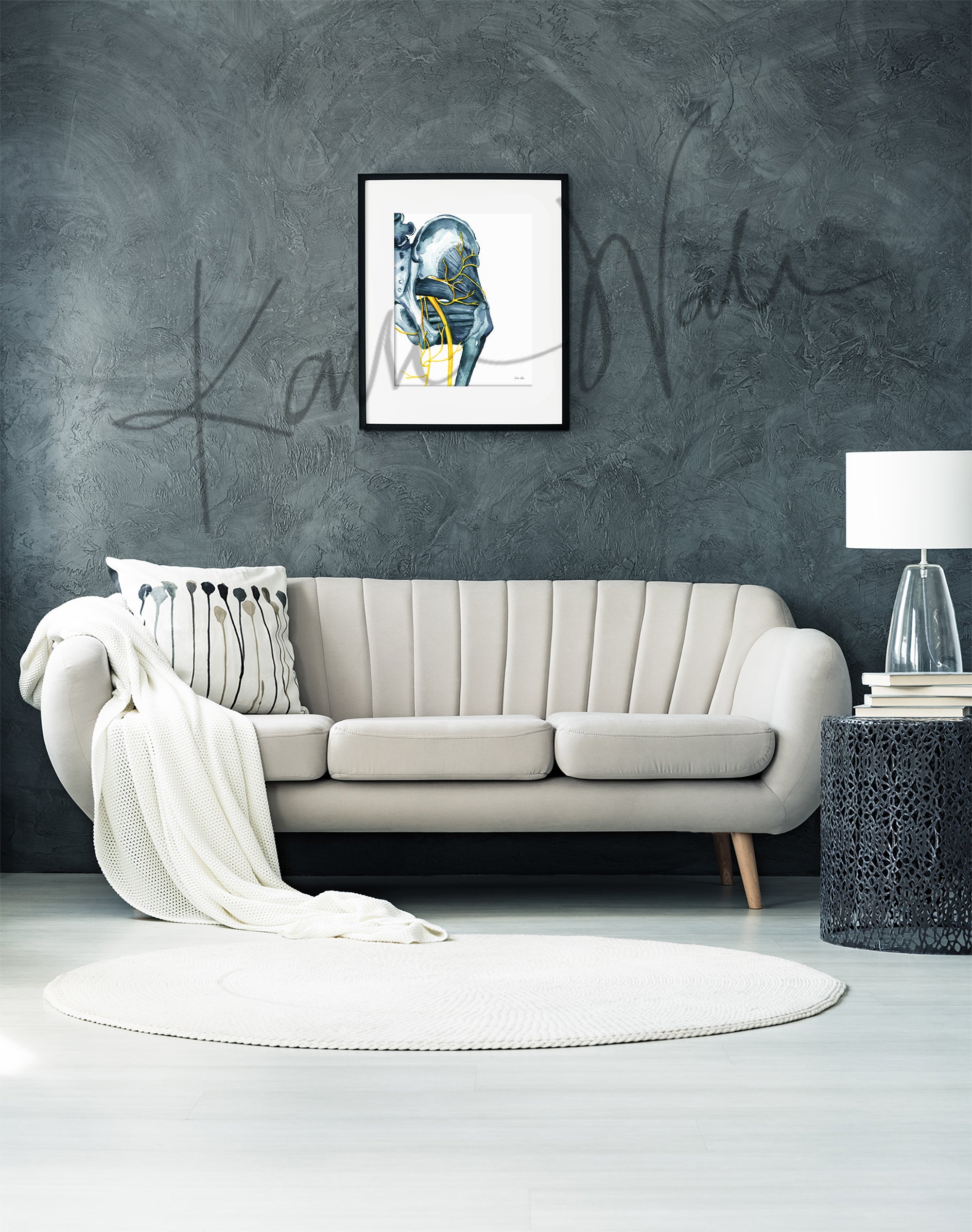 Sciatica Watercolor Print