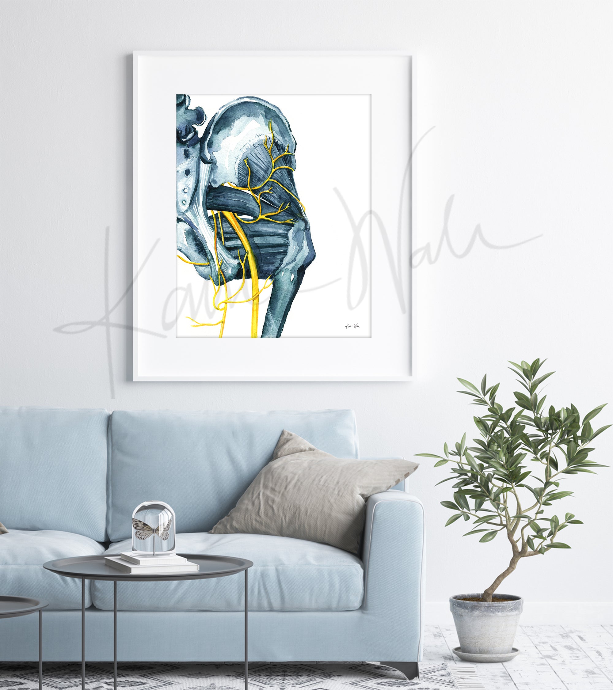 Sciatica Watercolor Print
