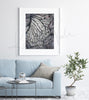 Superior Mesenteric Artery Watercolor Print