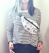 Bones and Joints Fanny Pack