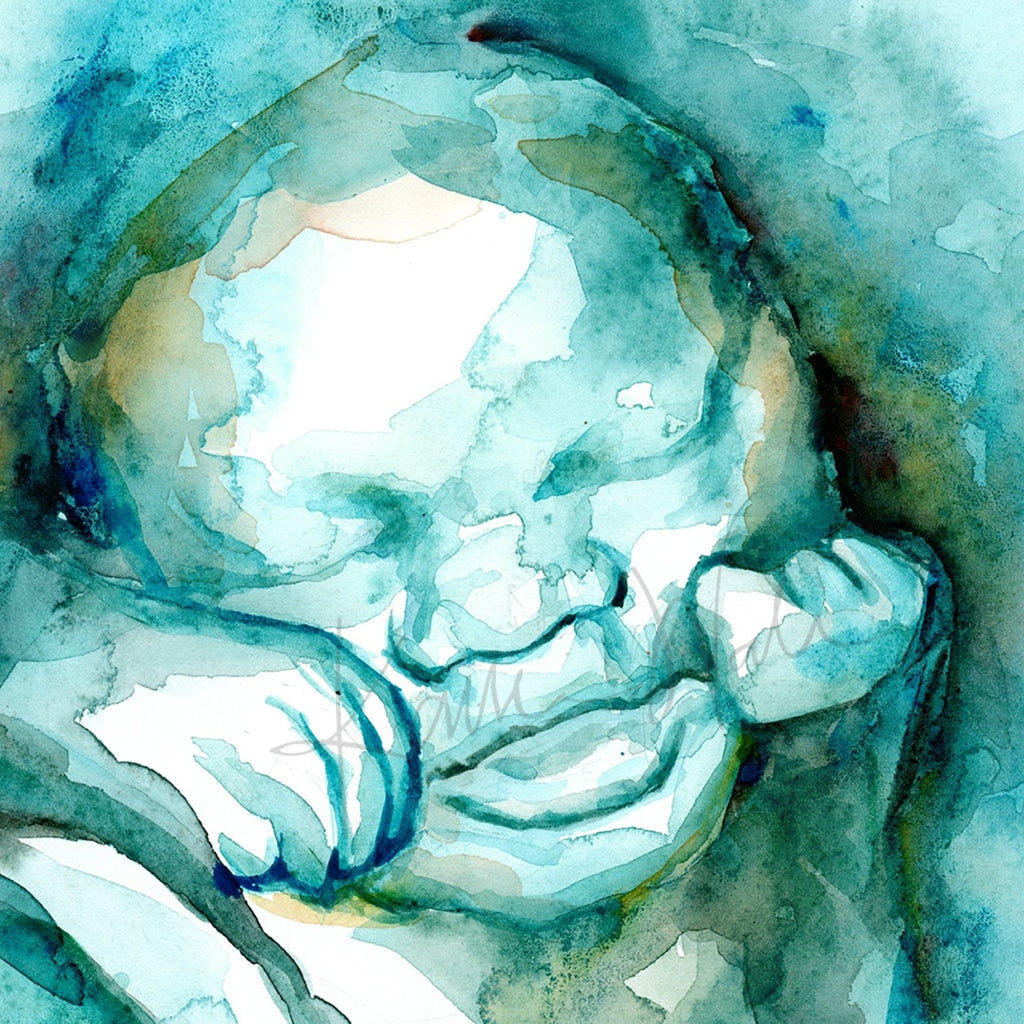 3D Ultrasound Watercolor Print