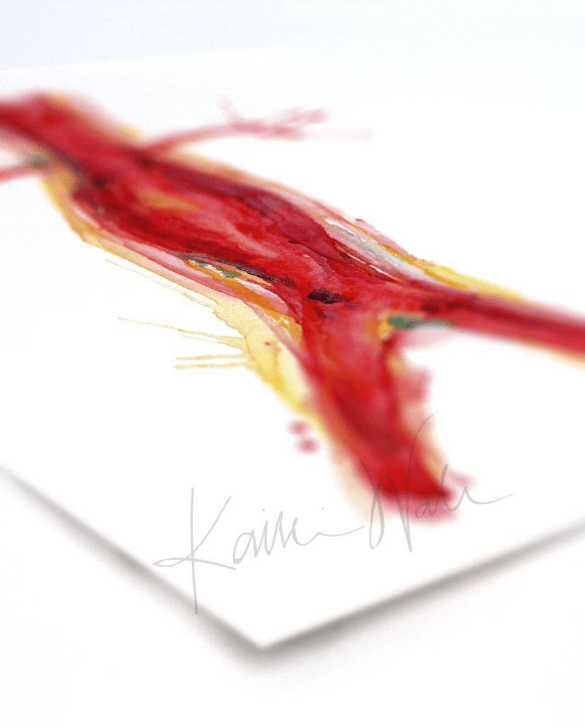 Abdominal Aneurysm Print Watercolor- gift for Doctor- Anatomy Art- cardiovascular art