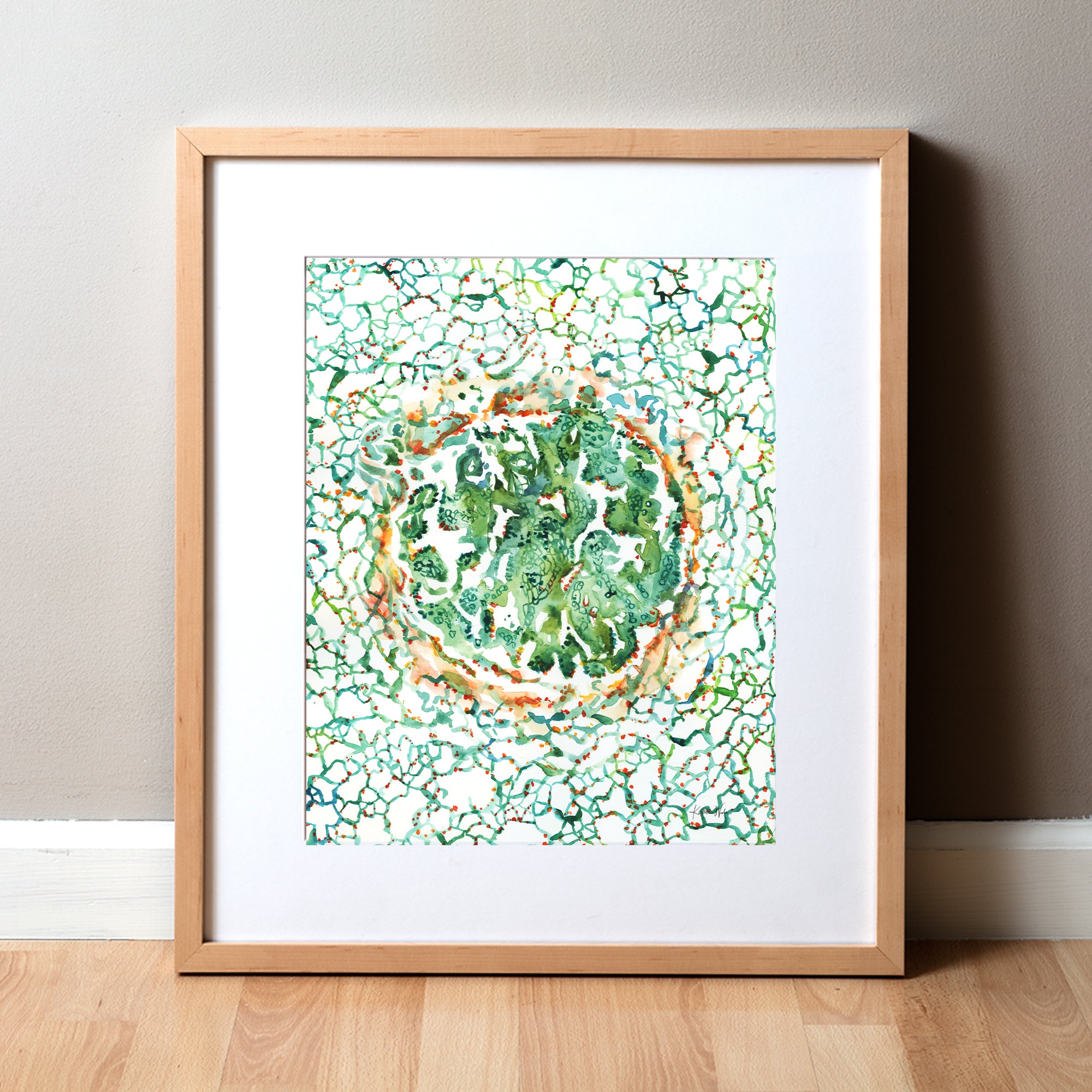 Framed watercolor painting of adenocarcinoma, with greens, reds, and yellows.