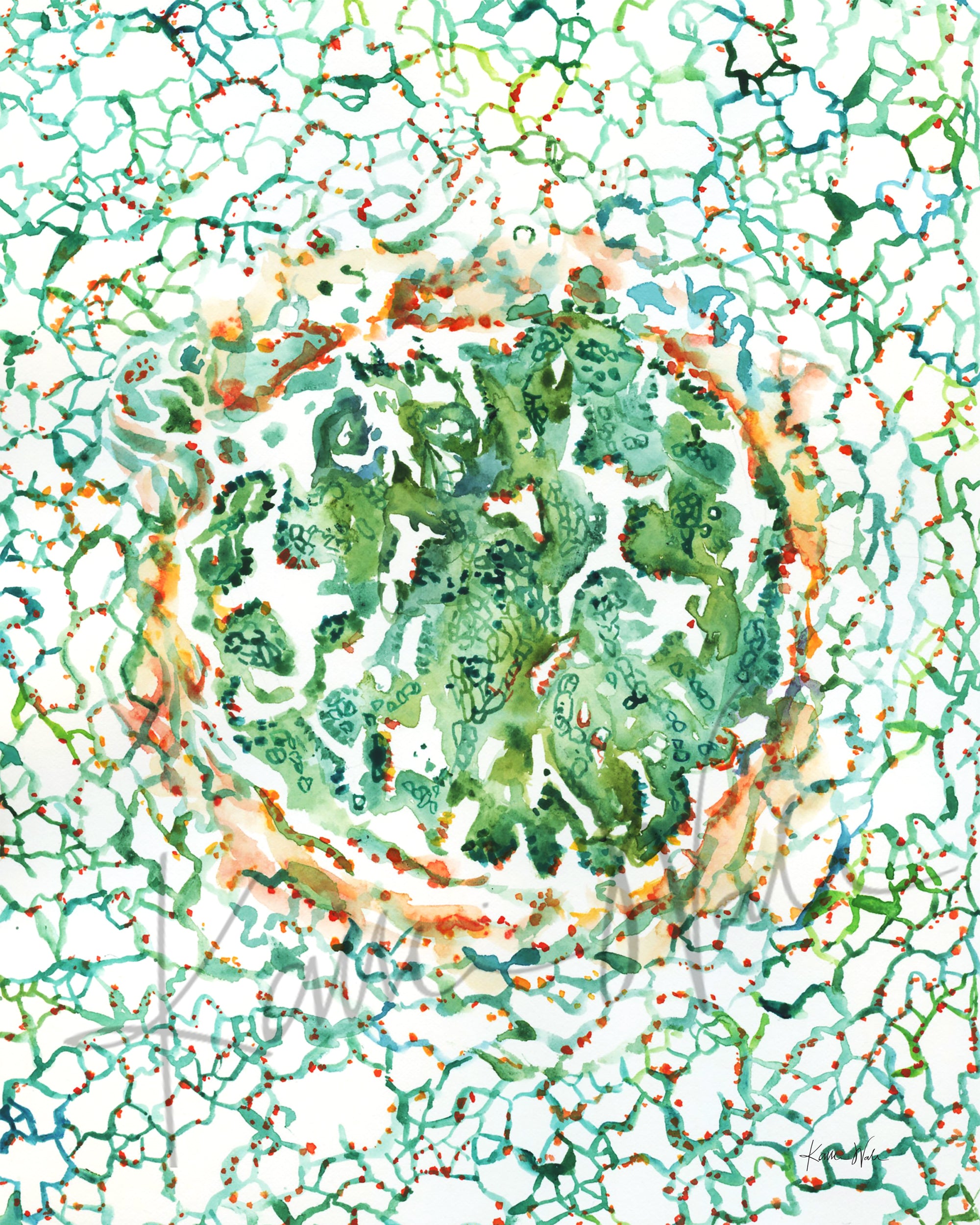 Unframed watercolor painting of adenocarcinoma, with greens, reds, and yellows.