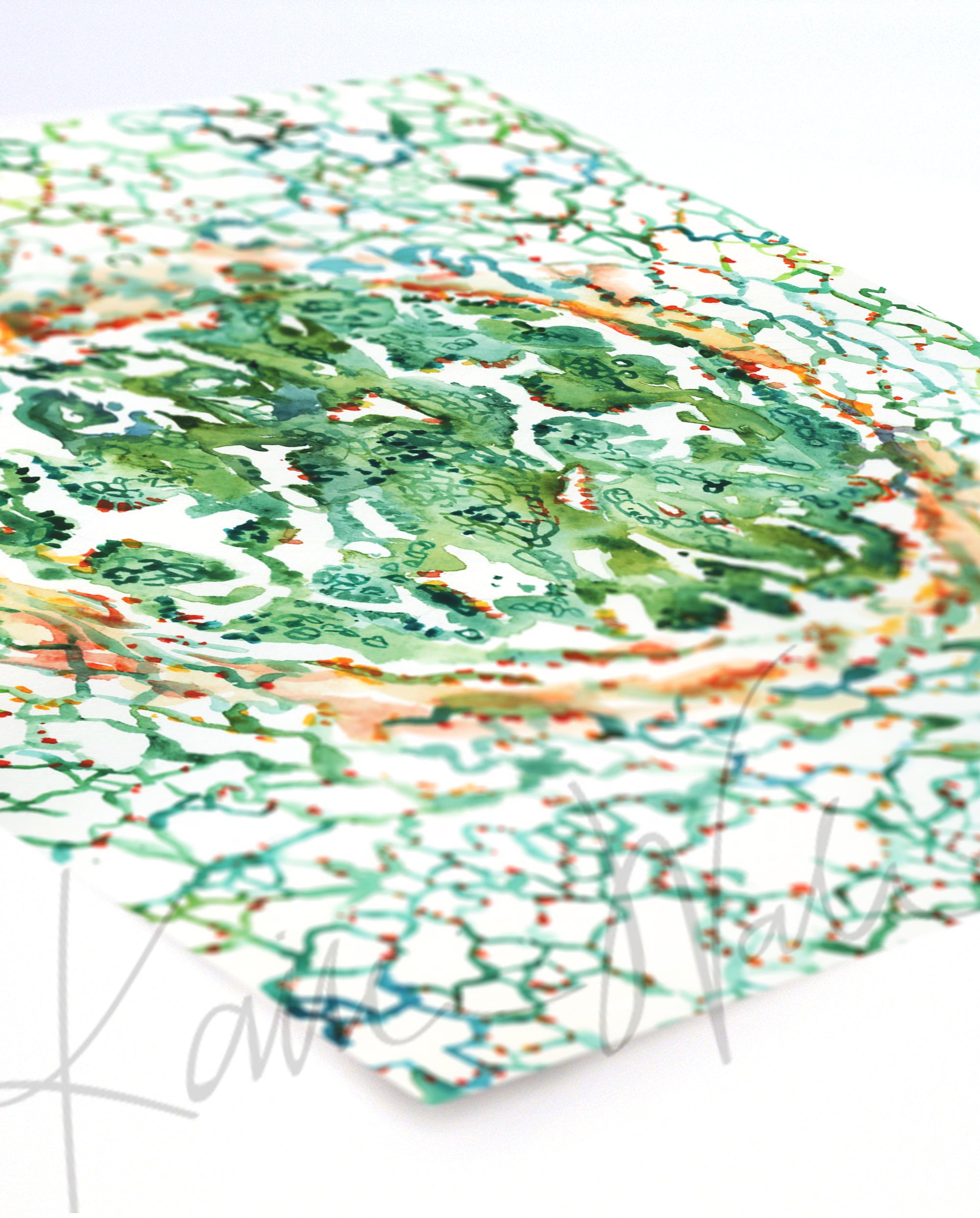 Unframed watercolor painting of adenocarcinoma, with greens, reds, and yellows. The print is at an angle.