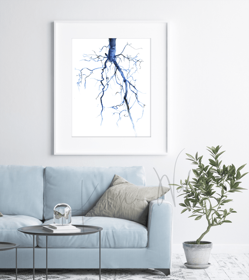 Aorta Angiogram Print Watercolor framed in a doctor's office- Professional clinic art- medical art- anatomy art- blue