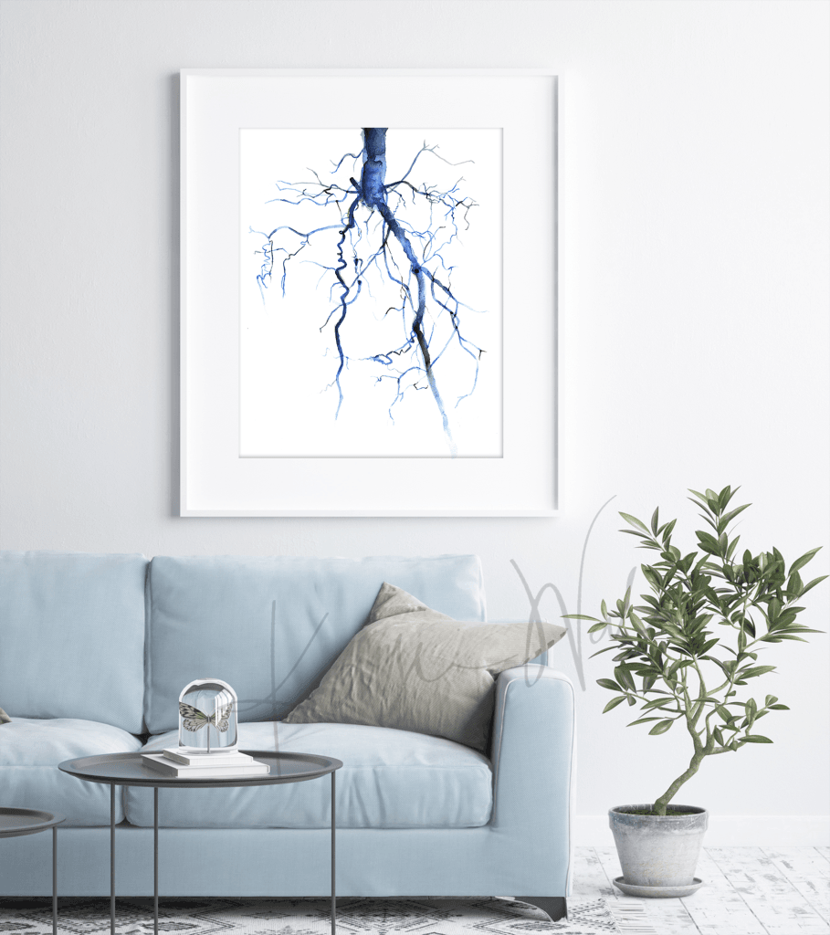 Aorta Angiogram Print Watercolor framed in a doctor's office- Professional clinic art- medical art- anatomy art- blue