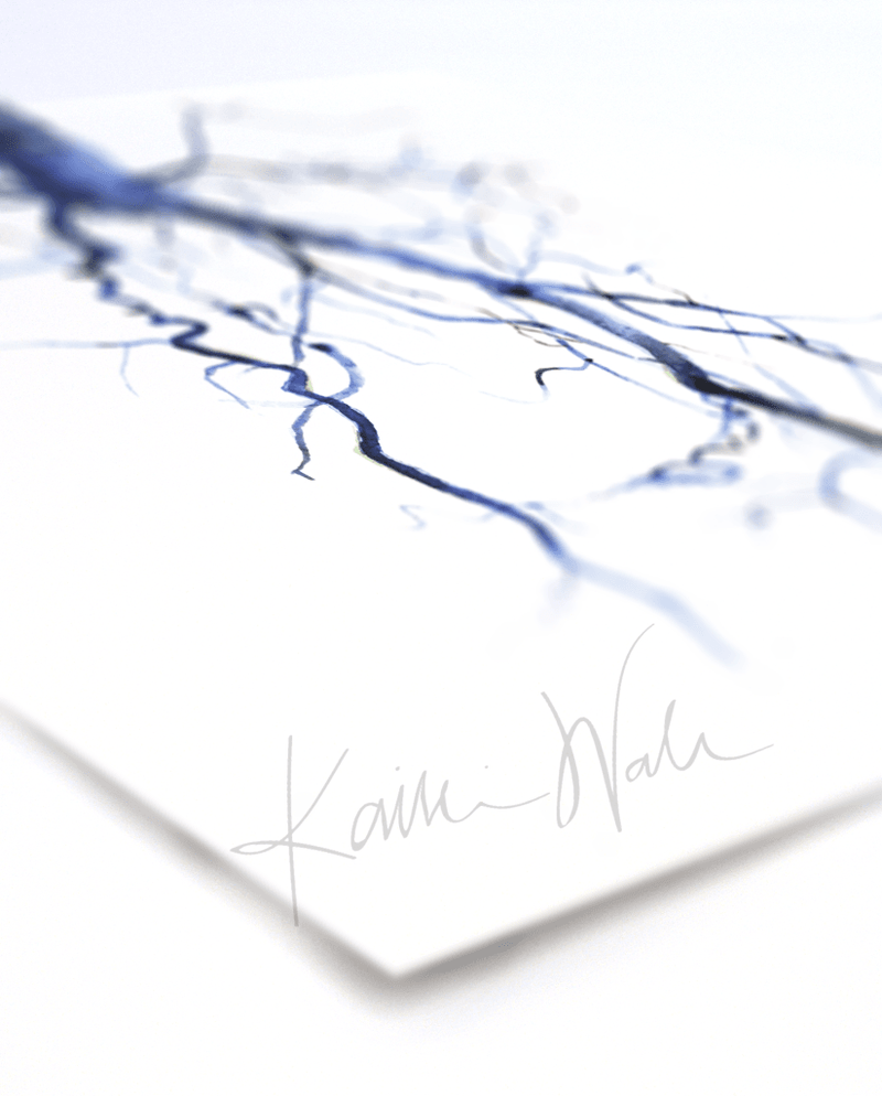 Aorta Angiogram Print Watercolor- Gift for Doctor- Anatomy Art- Gift for medical Student