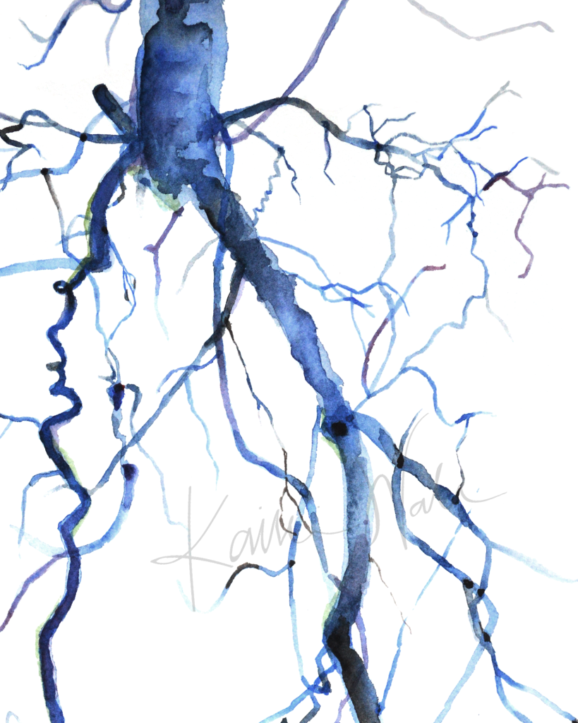 Aorta Angiogram Print Watercolor