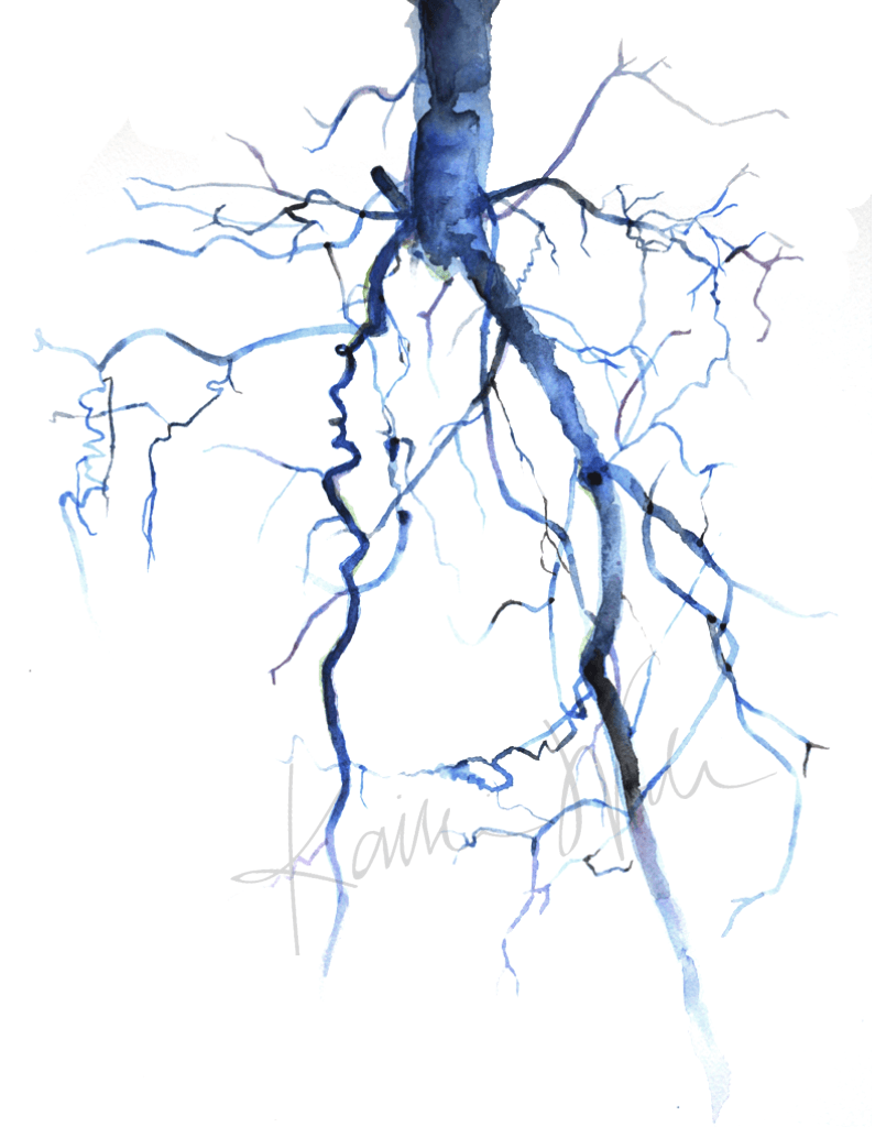 Aorta Angiogram Print Watercolor