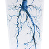 Aorta Angiogram Stainless Steel Insulated Travel Mug - 16oz