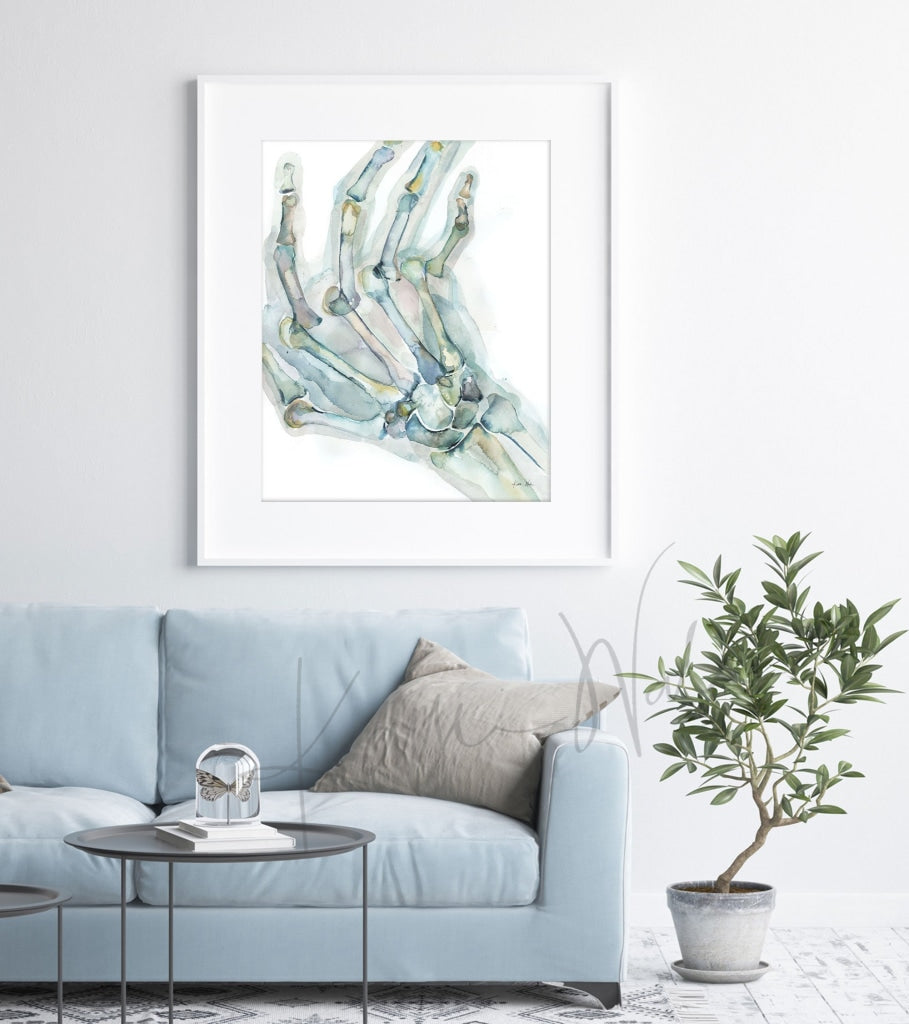 Rheumatoid Arthritis(Ra) Of The Hand Watercolor Print