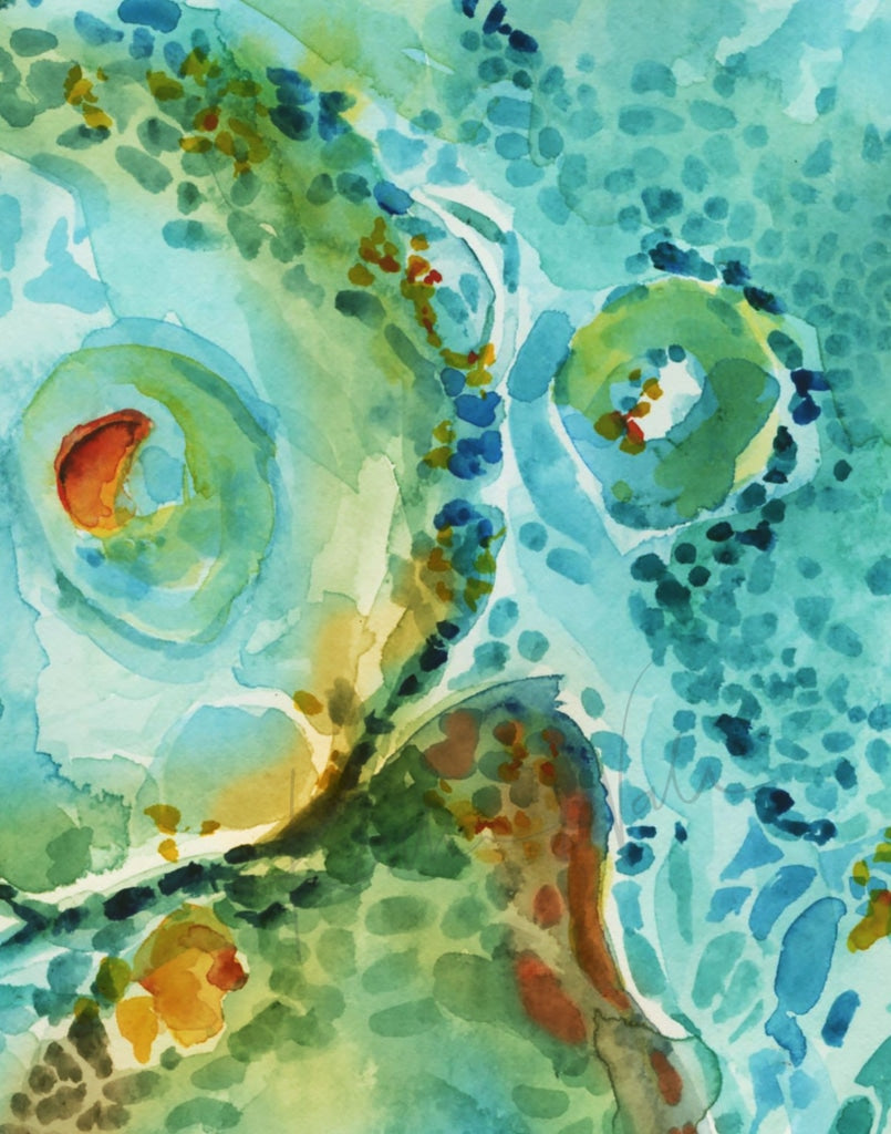 Basal Cell Carcinoma Watercolor Print