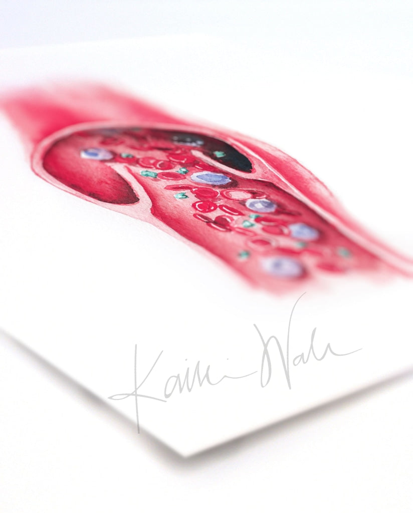 Blood Vessel Watercolor Print