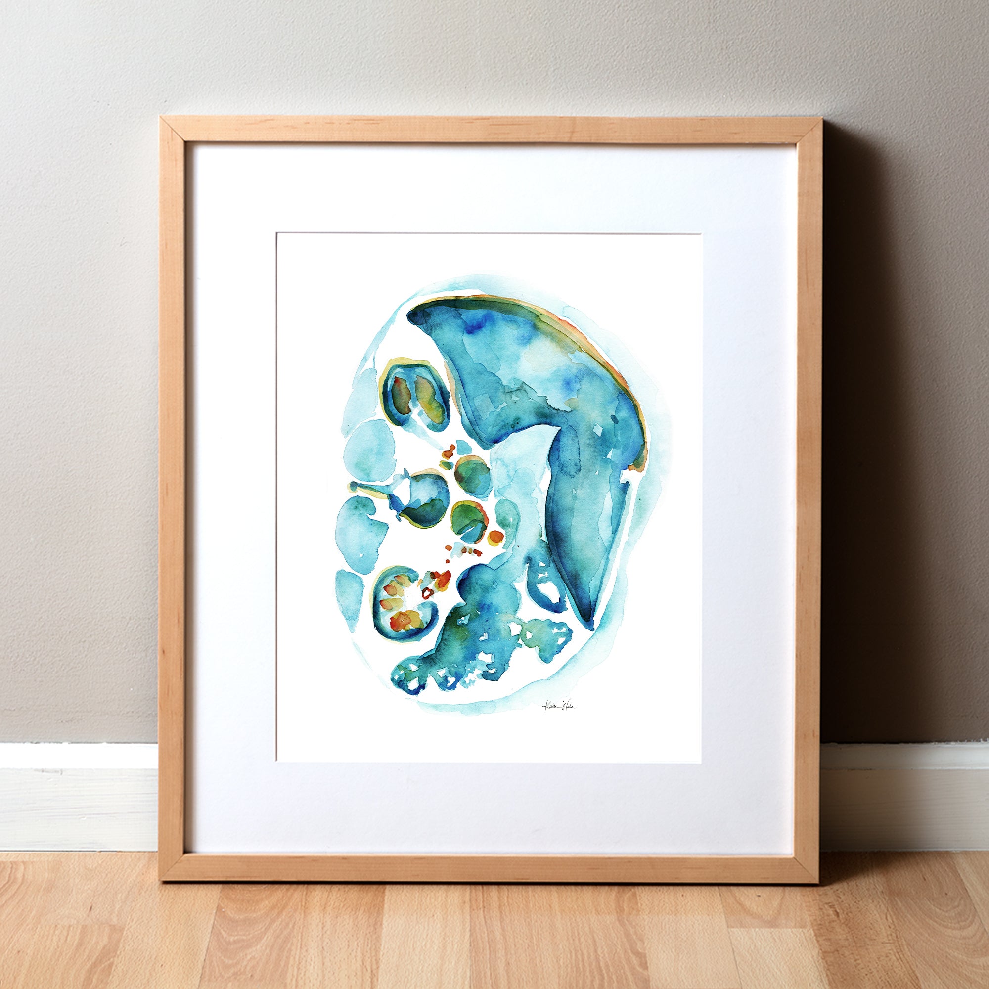 Original Custom IVF Embryo Watercolor in 5x7 or 9x12 Watercolor Paper 