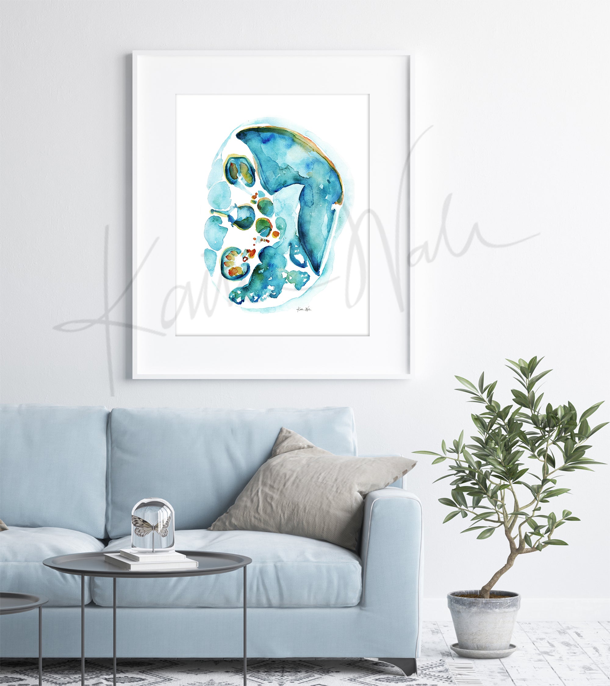 Original Custom IVF Embryo Watercolor in 5x7 or 9x12 Watercolor Paper 