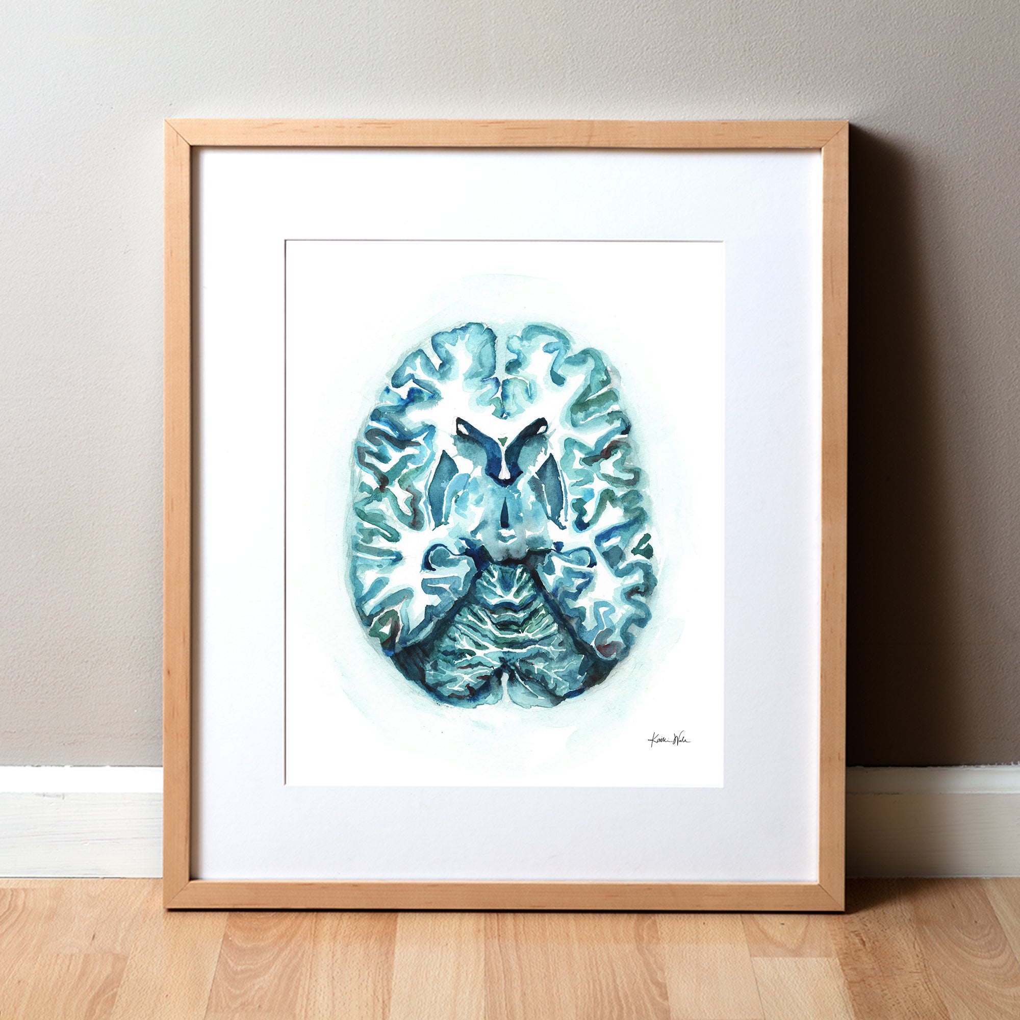 Framed watercolor painting showing a teal and blue transverse cut of the brain.