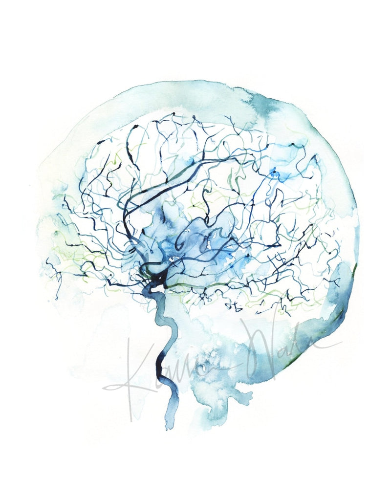 Cerebral Angiography Watercolor Print. Abstract anatomy art that is a great medical or doctor gift.