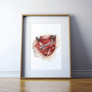 Neck Dissection I Print Watercolor