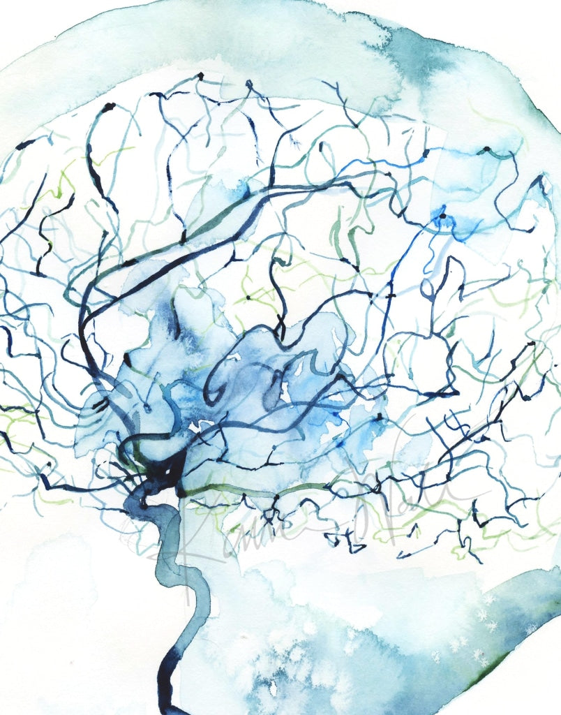 Cerebral Angiography Watercolor Print