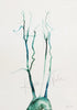 Anatomical Watercolor Painting Of The Aorta in Green Laying Flat